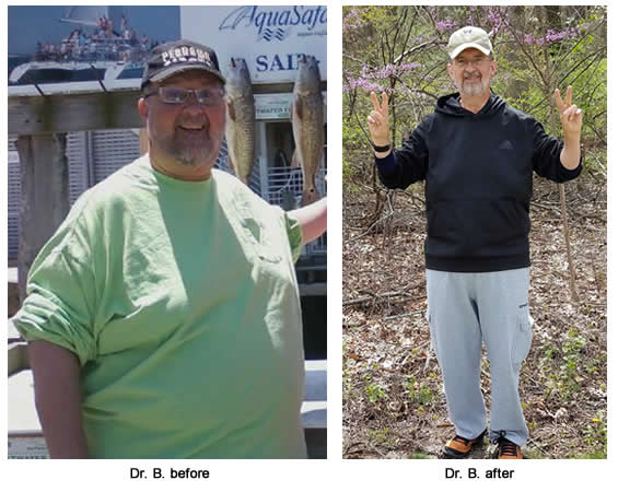 Dr B. Before and After